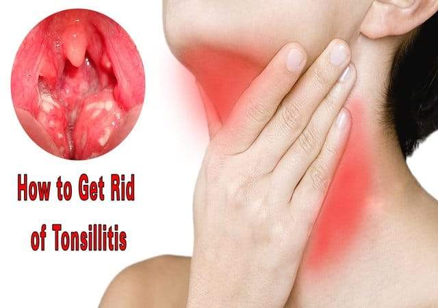 how to cure tonsillitis in 4 hours